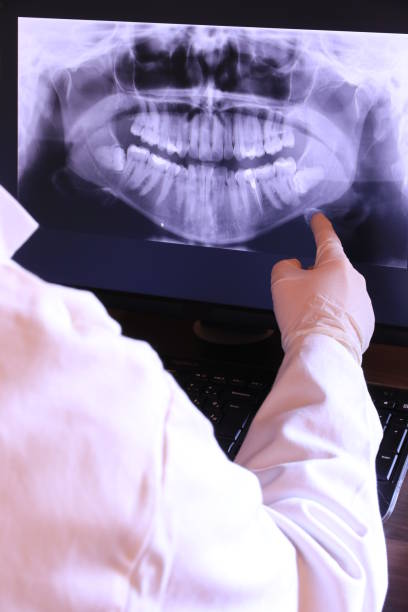 Best Emergency Treatment for Dental Infections or Abscesses in Claypool Hill, VA