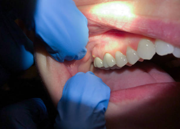 Best Weekend Emergency Dentist in Claypool Hill, VA