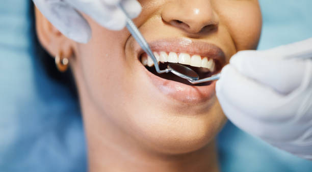 Best Emergency Dental Care for Broken or Chipped Teeth in Claypool Hill, VA